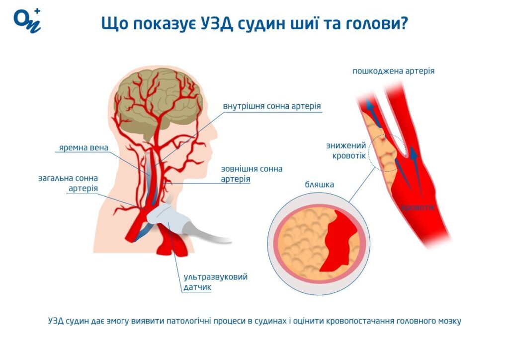 Як перевірити судини: оптимальний спосіб діагностики вашого здоров’я