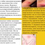 Яка різниця між фурункулами та карбункулами? Основні відмінності