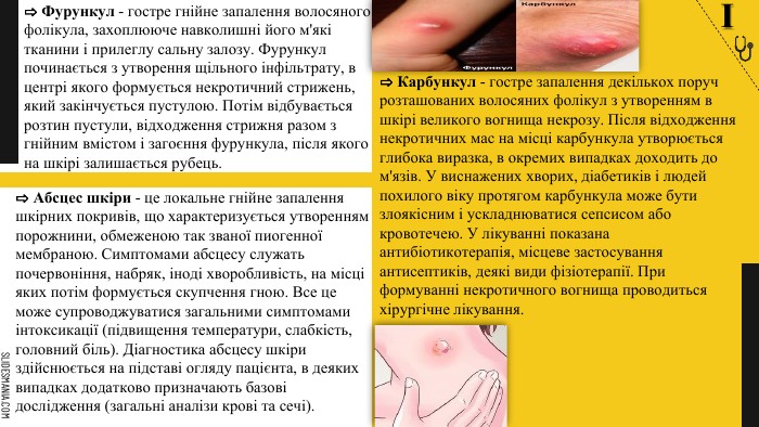 Яка різниця між фурункулами та карбункулами? Основні відмінності