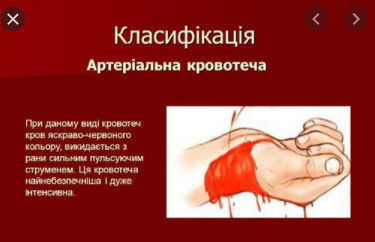 Яка рана виникає в результаті кульового поранення: наслідки та симптоми Яка рана виникає в результаті кульового поранення: наслідки та симптоми