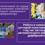Перед початком реанімації необхідно перевірити важливі фактори