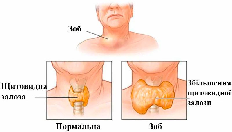 Як перевірити щитовидну залозу: прості способи діагностики та симптоми